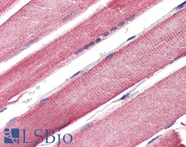 Anti-CPT1B antibody IHC of human skeletal muscle. Immunohistochemistry of formalin-fixed, paraffin-embedded tissue after heat-induced antigen retrieval. Antibody LS-B3232 concentration 75 ug/ml.