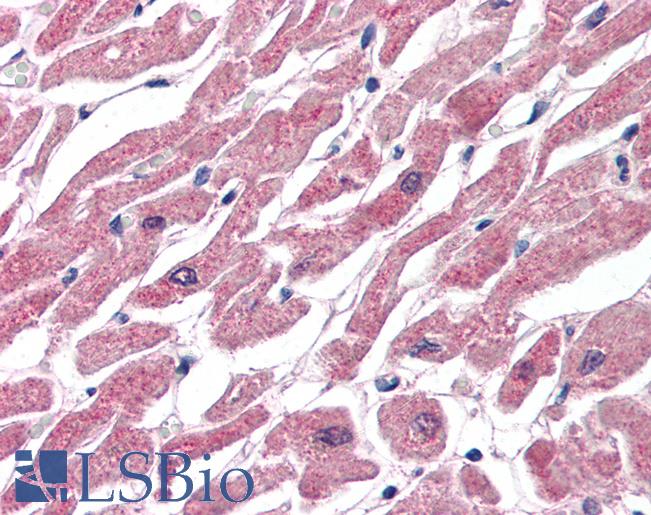 Anti-CPT1B antibody IHC of human heart. Immunohistochemistry of formalin-fixed, paraffin-embedded tissue after heat-induced antigen retrieval. Antibody LS-B3232 concentration 75 ug/ml.