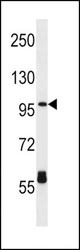 CPT1C Antibody western blot of HL-60 cell line lysates (35 ug/lane). The CPT1C antibody detected the CPT1C protein (arrow).