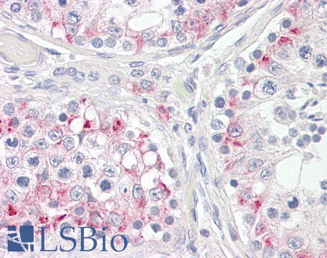 Anti-CPT1C antibody IHC of human testis. Immunohistochemistry of formalin-fixed, paraffin-embedded tissue after heat-induced antigen retrieval. Antibody LS-B8301 dilution 3.75 ug/ml.