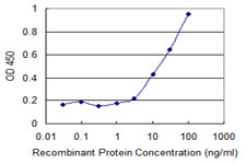 Detection limit for recombinant GST tagged CPT2 is 0.3 ng/ml as a capture antibody.