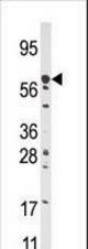 Western blot of anti-CPT2 antibody in HepG2 cell line lysate (35 ug/lane). CPT2(arrow) was detected using the purified antibody.