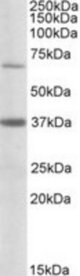 CPT2 antibody (0.5 ug/ml) staining of Human Liver lysate (35 ug protein in RIPA buffer). Primary incubation was 1 hour. Detected by chemiluminescence.