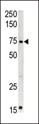 Western blot of anti-CPT2 antibody in mouse kidney tissue lysate (35 ug/lane). CPT2(arrow) was detected using the purified antibody.