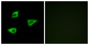Immunofluorescence of LOVO cells, using CHRM4 Antibody. The picture on the right is treated with the synthesized peptide.