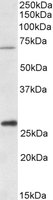 CPT2 antibody (1 ug/ml) staining of Human Liver lysate (35 ug protein/ml in RIPA buffer). Primary incubation was 1 hour. Detected by chemiluminescence.