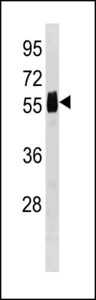 CPVL Antibody western blot of 293 cell line lysates (35 ug/lane). The CPVL antibody detected the CPVL protein (arrow).