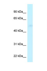 CPVL antibody LS-C145933 Western blot of 435S Cell lysate. Antibody concentration 1 ug/ml.