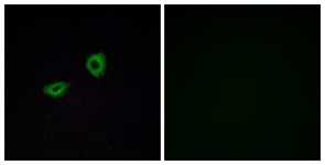 Immunofluorescence of A549 cells, using CHRM5 Antibody. The picture on the right is treated with the synthesized peptide.