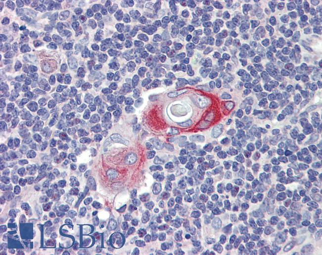 Anti-CPXCR1 antibody IHC of human thymus. Immunohistochemistry of formalin-fixed, paraffin-embedded tissue after heat-induced antigen retrieval. Antibody LS-B4030 concentration 10 ug/ml.