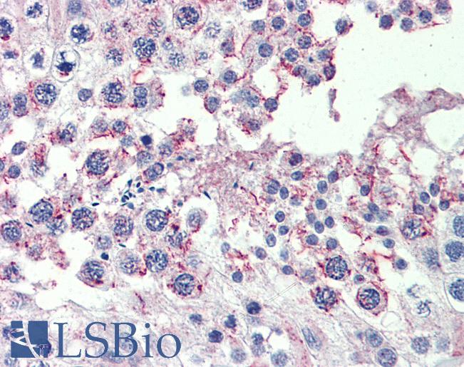 Anti-CPXCR1 antibody IHC of human testis. Immunohistochemistry of formalin-fixed, paraffin-embedded tissue after heat-induced antigen retrieval. Antibody LS-B4030 concentration 10 ug/ml.
