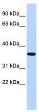 Western analysis of fetal brain lysate.