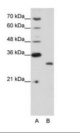 A: Marker, B: Jurkat Cell Lysate