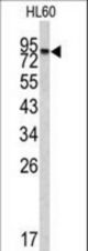 Western blot of CPXM2 antibody in HL60 cell line lysates (35 ug/lane). CPXM2 (arrow) was detected using the purified antibody.
