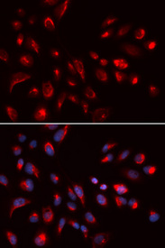 Immunofluorescence analysis of U20S cell using CHRM5 antibody. Blue: DAPI for nuclear staining.