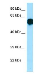 CR1L / CRRY antibody Western Blot of Fetal Brain.