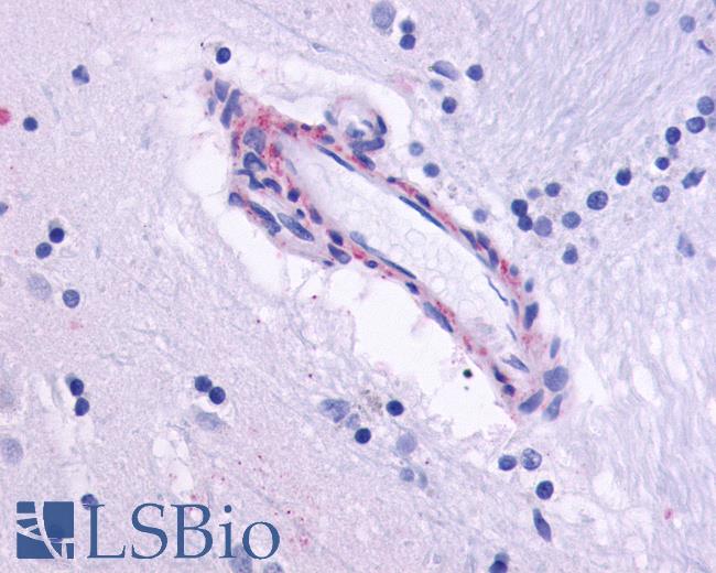 Anti-CHRM5 antibody LS-A1338 IHC of human brain, vessel. Immunohistochemistry of formalin-fixed, paraffin-embedded tissue after heat-induced antigen retrieval.