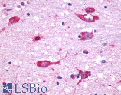Anti-CHRM5 antibody LS-A1334 IHC of human brain, neurons and glia. Immunohistochemistry of formalin-fixed, paraffin-embedded tissue after heat-induced antigen retrieval.