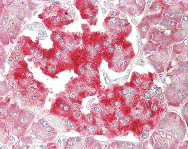 Human Pancreas: Formalin-Fixed, Paraffin-Embedded (FFPE)