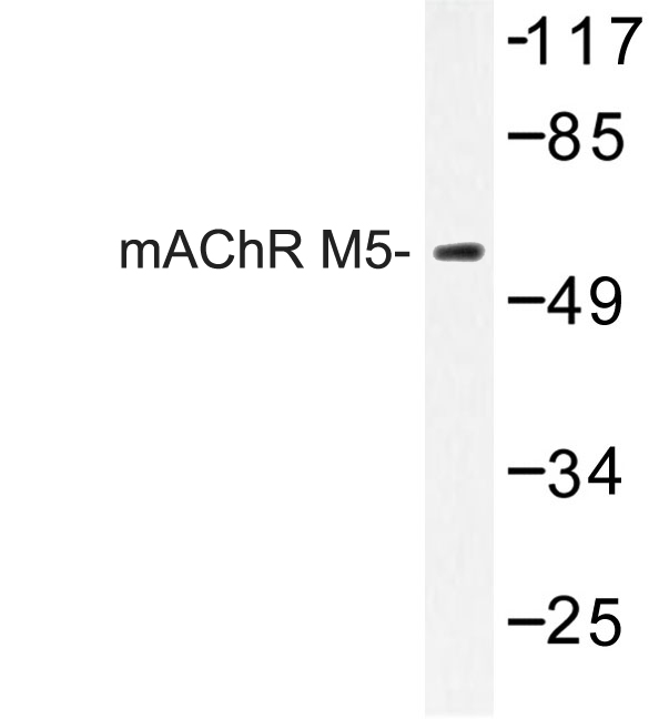 Western blot of Adenosine mAChR M5 (L321) pAb in extracts from Jurkat cells.