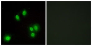 Immunofluorescence of A549 cells, using GA45G Antibody. The picture on the right is treated with the synthesized peptide.