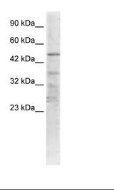 Jurkat Cell Lysate