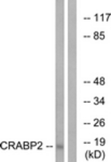 Western blot of extracts from HT-29 cells, using CRABP2 Antibody. The lane on the right is treated with the synthesized peptide.
