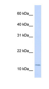 CRABP2 antibody LS-C110663 Western blot of 721_B cell lysate.