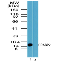 Western blot of CRABP2 in HCT116 cell lysate in the 1) absence and 2) presence of immunizing peptide using LS-C148357 at 1.0 ug/ml.