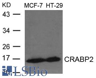 Western blot of extracts from MCF-7 and HT-29 cells using CRABP2 antibody.