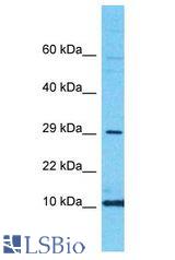 CRABP2 antibody Western Blot of HeLa. Antibody dilution: 1 ug/ml.