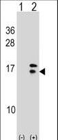 Western blot of CRABP2 (arrow) using rabbit polyclonal CRABP2 Antibody. 293 cell lysates (2 ug/lane) either nontransfected (Lane 1) or transiently transfected (Lane 2) with the CRABP2 gene.
