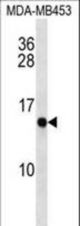 CRABP2 Antibody western blot analysis MDA-MB453 cell line lysates (35 ug/lane). The CRABP2 antibody detected the CRABP2 protein (arrow).