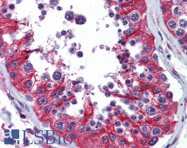 Anti-CRADD / RAIDD antibody IHC of human testis. Immunohistochemistry of formalin-fixed, paraffin-embedded tissue after heat-induced antigen retrieval. Antibody LS-B3738 concentration 10 ug/ml.