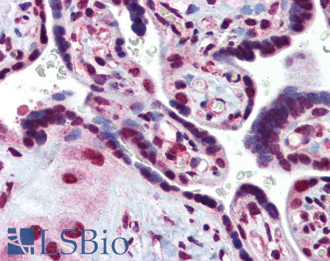 Anti-CRADD / RAIDD antibody IHC of human placenta. Immunohistochemistry of formalin-fixed, paraffin-embedded tissue after heat-induced antigen retrieval. Antibody LS-B3738 concentration 10 ug/ml.