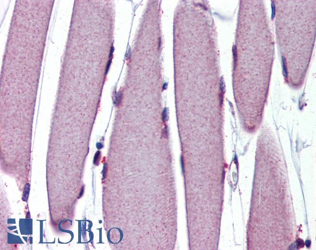 Anti-CRADD / RAIDD antibody IHC of human skeletal muscle. Immunohistochemistry of formalin-fixed, paraffin-embedded tissue after heat-induced antigen retrieval. Antibody LS-B3738 concentration 10 ug/ml.