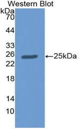 Western blot of recombinant CRADD / RAIDD.