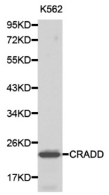 Western blot analysis of K562 cell lysate using CRADD antibody.