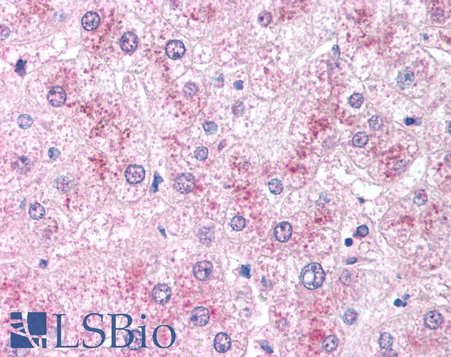 Anti-CRADD / RAIDD antibody IHC of human liver. Immunohistochemistry of formalin-fixed, paraffin-embedded tissue after heat-induced antigen retrieval. Antibody LS-B1349 concentration 5 ug/ml.