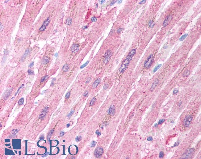 Anti-CRADD / RAIDD antibody IHC of human heart. Immunohistochemistry of formalin-fixed, paraffin-embedded tissue after heat-induced antigen retrieval. Antibody LS-B1349 concentration 5 ug/ml.