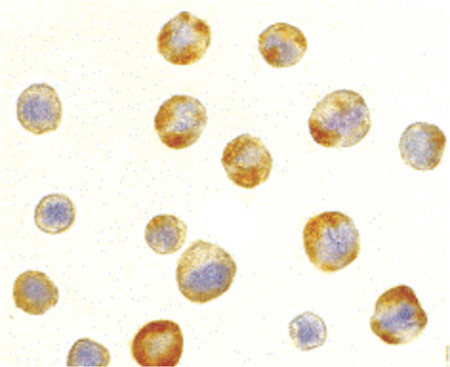 Immunocytochemistry of RAIDD in HeLa cells with RAIDD antibody at 5 ug/ml.