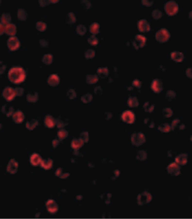 Immunofluorescence of RAIDD in HeLa cells with RAIDD antibody at 20 ug/ml.