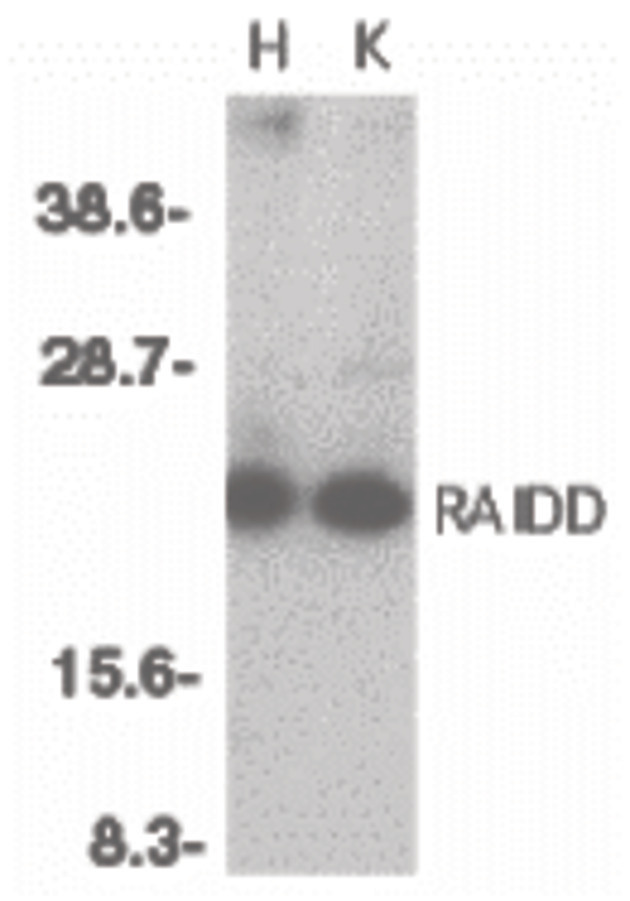 Western blot of RAIDD in whole cell lysates from HeLa (H) or K562 (K) cells with RAIDD antibody at 1:500 dilution.