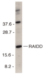 Western blot of RAIDD in HeLa total cell lysate with RAIDD antibody at 1 ug/ml.