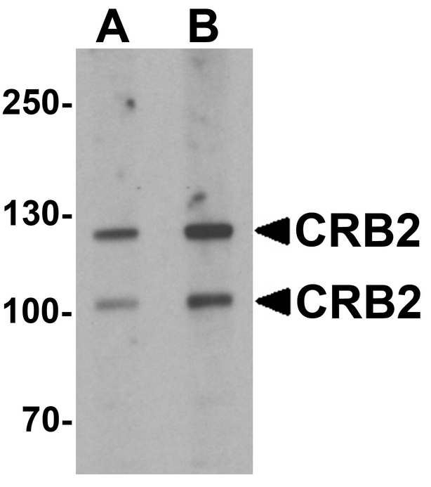 Western blot analysis of CRB2 in rat brain tissue lysate with CRB2 antibody at 1 ug/ml