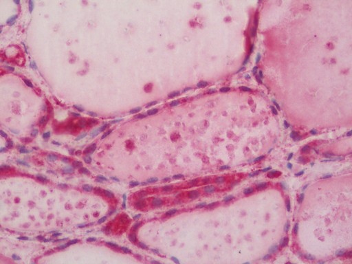 Human Thyroid: Formalin-Fixed, Paraffin-Embedded (FFPE)