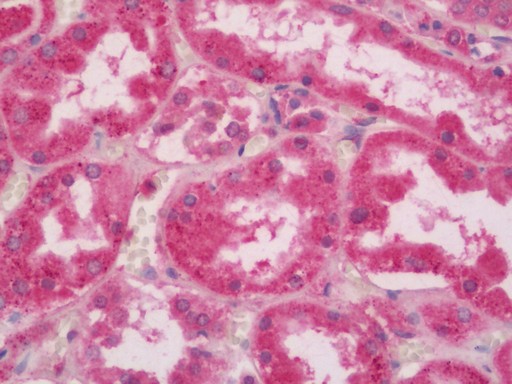 Human Kidney: Formalin-Fixed, Paraffin-Embedded (FFPE)