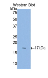 Western blot of recombinant CRBPIV / RBP7.