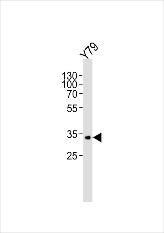 Western blot of lysate from Y79 cell line with CRX Antibody. Antibody was diluted at 1:1000. A goat anti-rabbit IgG H&L (HRP) at 1:5000 dilution was used as the secondary antibody. Lysate at 35 ug.