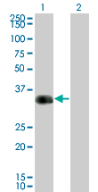 Western Blot analysis of CRX expression in transfected 293T cell line by CRX monoclonal antibody (M01), clone F6-C2.Lane 1: CRX transfected lysate(32.261 KDa).Lane 2: Non-transfected lysate.